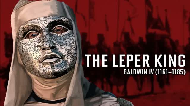 BALDWIN 1V1
